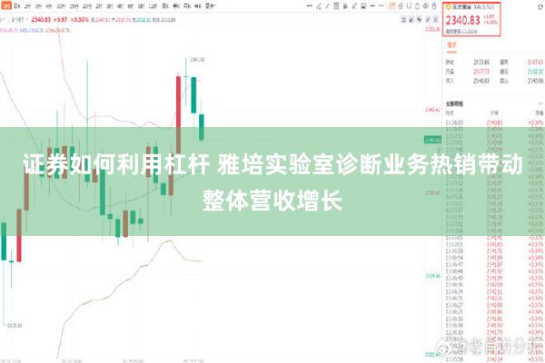 证券如何利用杠杆 雅培实验室诊断业务热销带动整体营收增长